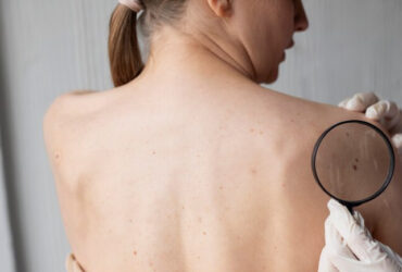 Dermatologia
